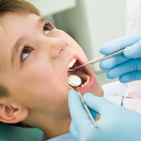 Close-up of little boy opening his mouth during dental checkup
