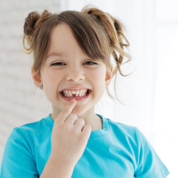 The kid lost a tooth. Baby without a tooth. Portrait of a little girl no tooth.